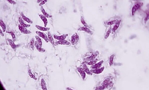 Il parassita protozoo Toxoplasma gondii è l'agente eziologico della toxoplasmosi