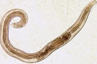 umana parassiti pinworm